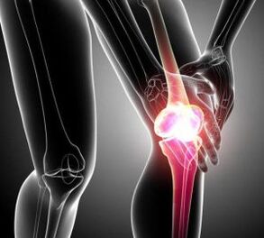 dolor de rodilla en artritis y osteoartritis