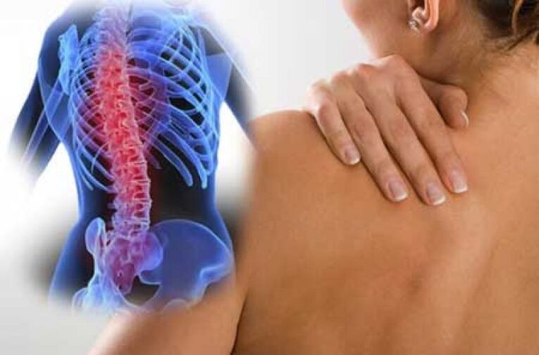 Durante una exacerbación de la osteocondrosis de la columna torácica, se produce dolor de espalda. 