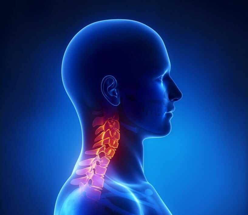 La osteocondrosis cervical es una patología de la columna vertebral, de la que puede deshacerse en casa. 