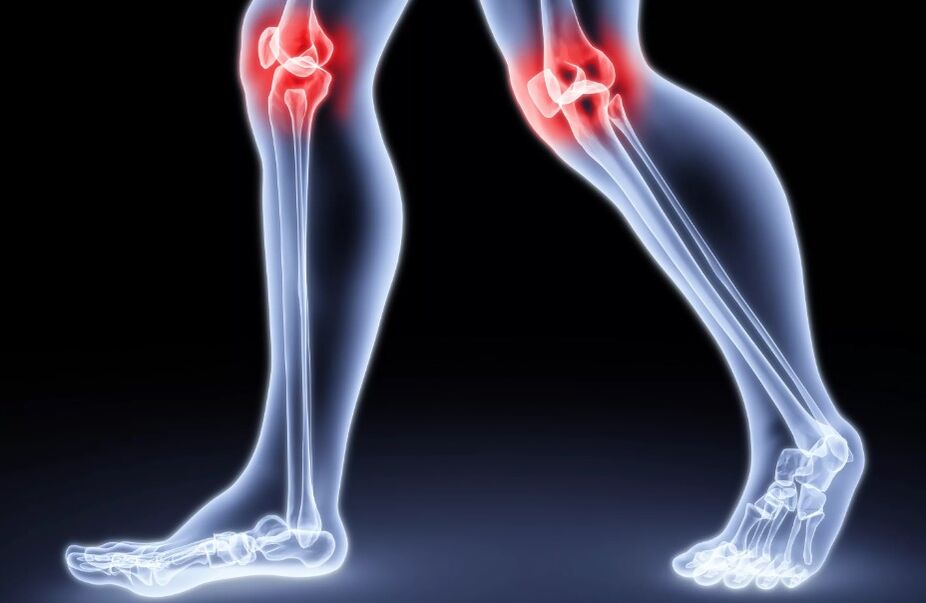 Dolor articular