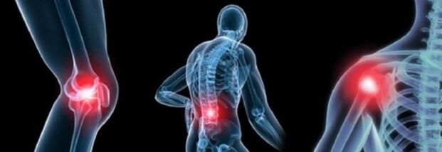 Tipos de dolor con artrosis