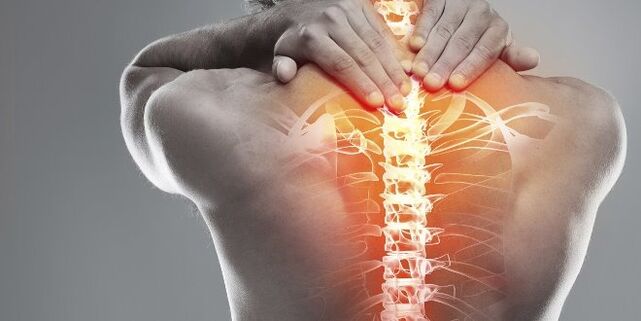 Opciones médicas para la terapia cervical de la osteocondosis cervical