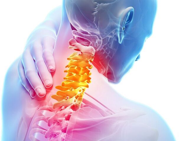 Síntomas y fases del desarrollo de la osteocondosis cervical